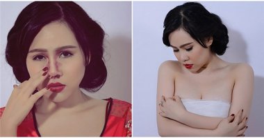 Diễn viên "lùn nhất showbiz Việt" công khai ảnh thẩm mỹ đau đớn