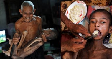 Rơi nước mắt ông lão chăm sóc đứa cháu “xương khô” suốt 16 năm trời