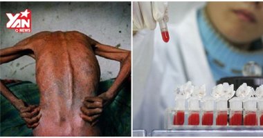 Tin vui: Đã có người được chữa khỏi HIV/AIDS