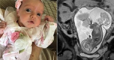 Kì lạ ca sinh con "hơi bị sai sai": em bé được chào đời đến tận… 2 lần