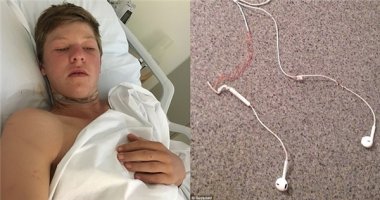 Chàng trai 16 tuổi suýt đứt cổ chỉ vì vừa đeo tai nghe vừa lái xe