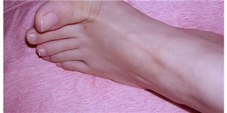 Đặc điểm của bàn chân cho bạn biết nguồn gốc bạn xuất thân từ đâu