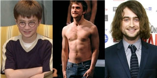 Nhìn lại sự thay đổi của Daniel Radcliffe theo năm tháng