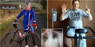 Kì lạ người đàn ông bỗng dưng đam mê đua xe đạp sau khi được ghép tim