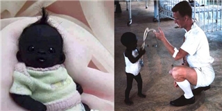 Cư dân mạng “phát sốt” với “em bé đen nhất thế giới”
