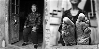 Bộ ảnh chân thực về những người phụ nữ cuối cùng sở hữu đôi chân gót sen