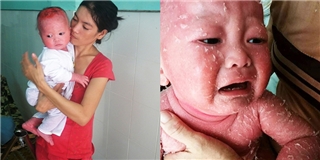 Rớt nước mắt trước hoàn cảnh của em bé mắc bệnh hiểm nghèo