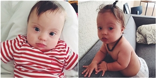 Ngạc nhiên với em bé “người mẫu” 11 tháng tuổi mắc hội chứng Down