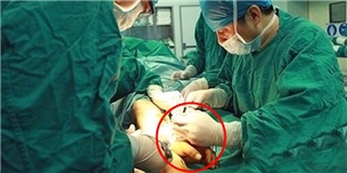 Hết hồn ca phẫu thuật nối tay vào chân của một người đàn ông