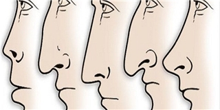 Hình dáng mũi tiết lộ gì về tính cách của bạn?