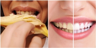 Bí quyết khắc phục răng vàng ố cực hiệu quả