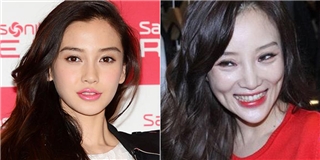 7 sao nữ châu Á có gương mặt cứng đơ vì thẩm mỹ