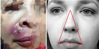 Bằng chứng vùng tam giác tử thần trên mặt là có thật
