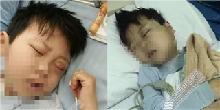 Cậu bé bị mù sau khi bị cô giáo tát liên tiếp vào mặt