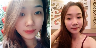 Nữ sinh bị tạt axít ở Sài Gòn viết tâm thư lên mạng xã hội