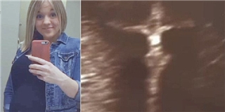 Bạn sẽ sốc khi biết mẹ bầu này thấy gì trong bức ảnh siêu âm thai nhi