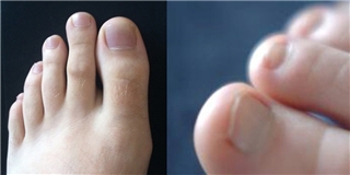 Nhìn ngón chân cũng có thể đoán được tính cách chuẩn không cần chỉnh