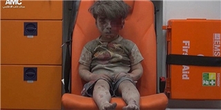 Hình ảnh cậu bé Syria bị thương làm chấn động cả thế giới