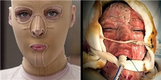 Đánh ghen: Cô gái chịu đựng bộ mặt quỷ sau lớp mặt nạ suốt 2 năm