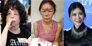 Ham đẹp như gái Hàn, hàng loạt phụ nữ khóc hận vì phẫu thuật hỏng