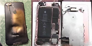 Nối bước Galaxy Note7, iPhone 7 phát nổ khiến người đàn ông bỏng mặt
