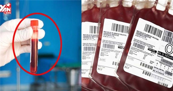 Nếu mang nhóm máu O, nhất định phải biết điều này để giữ mạng sống