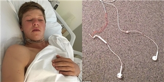 Chàng trai 16 tuổi suýt đứt cổ chỉ vì vừa đeo tai nghe vừa lái xe