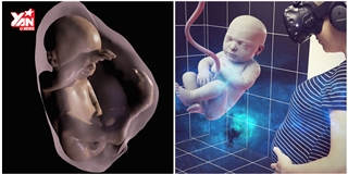Công nghệ mới giúp nhìn thai nhi rõ như thật, hơn hẳn siêu âm